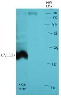 L7/L12 | Ribosomal protein in the group Antibodies Plant/Algal / DNA/RNA/Cell Cycle / Translation at Agrisera AB (Antibodies for research) (AS08 331)